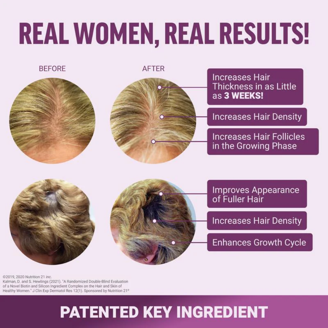 Hair Growth Accelerator Soft Chews