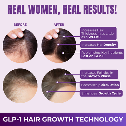 GLP-1 Hair Growth Accelerator Soft Chews