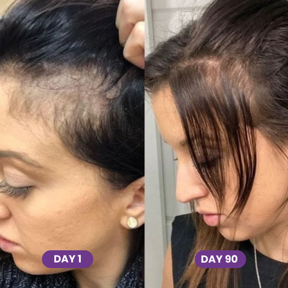 GLP-1 Hair Growth Accelerator Soft Chews