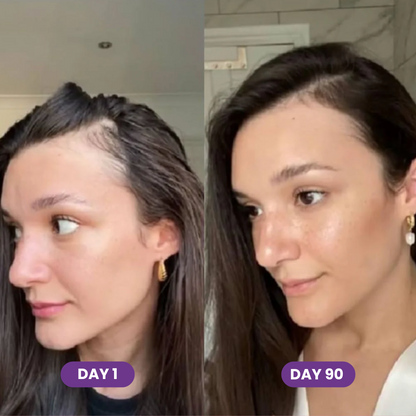 GLP-1 Hair Growth Accelerator Soft Chews