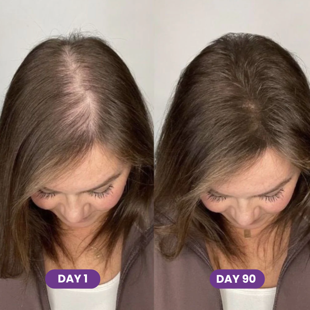 GLP-1 Hair Growth Accelerator Soft Chews